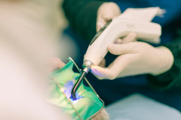 Detail of a dentist performing surgery with anesthesia on a patient for root canal treatment and regeneration. No people are recognizable. - 727125408