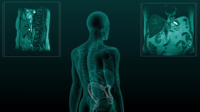 Magnetic resonance tomography  scan of the human digestive system. Anatomically accurate 3d render animation of the large intestine