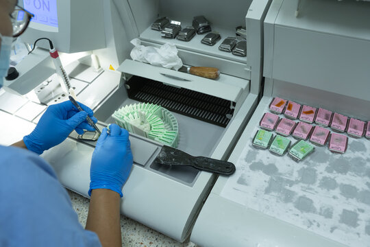 The medical scientist is preparing a specimen for pathological examination in a hospital.