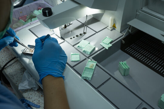 The medical scientist is preparing a specimen for pathological examination in a hospital.