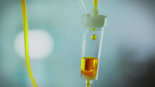 IV drip in action. Conducts drip treatment. The bright liquid medicine drips slowly while keeping the level in the expansion capsule. Supported by modern technology, iv drip drop falls