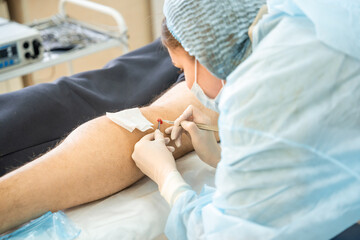 Dermatologist surgeon removes skin diseases with scalpel and tweezers, operation process - obrazy, fototapety, plakaty