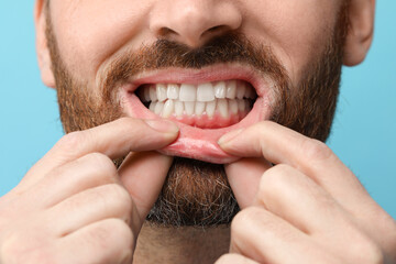 Man showing his healthy teeth and gums on light blue background, closeup
