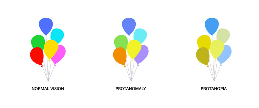 Protanomaly and protanopia