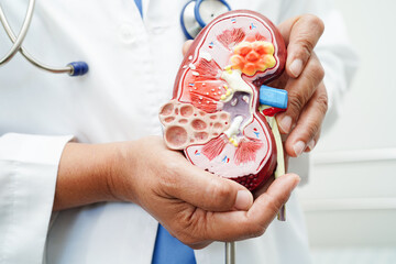 Chronic kidney disease, doctor with model for treatment urinary system, urology, Estimated...