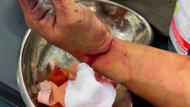 The wound was scratched on the wrist and bleeding