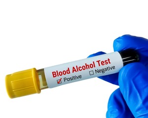 Tube tube with sample for Blood alcohol test