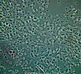 Photomicrograph: Fungal colony, skin scraping for fungus test. Invert image under microscopic image.