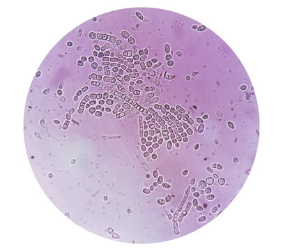 Photomicrograph: Fungal colony, skin scraping for fungus test. Invert image under microscopic image.