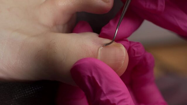 Podolog in pink gloves removes the cuticle on the nails using hardware. Procedure pedicure in spa salon