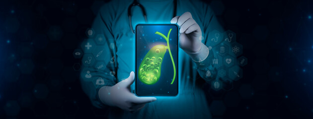 Color image of the gallbladder with stones inside. The doctor studies and analyzes gallstones. With experience in digital technology. - obrazy, fototapety, plakaty
