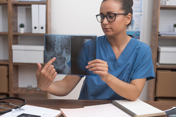 female doctor in eyeglasses pointing finger on x-ray film showing directly to camera during online...