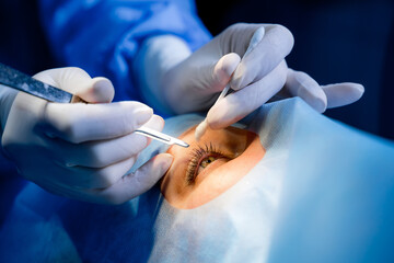 Surgeon is performing surgery on patient's eye using scalpel and forceps.