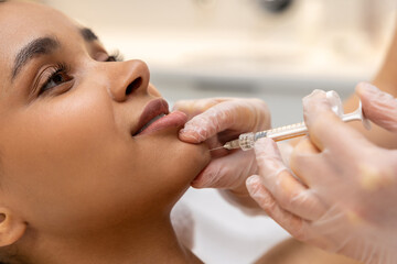 Dark-skinned woman having hyaluronic acid injection into lips