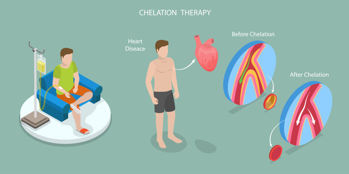 3D Isometric Flat Vector Illustration of Chelation Therapy, Toxic Heavy Metal Medical Treatment