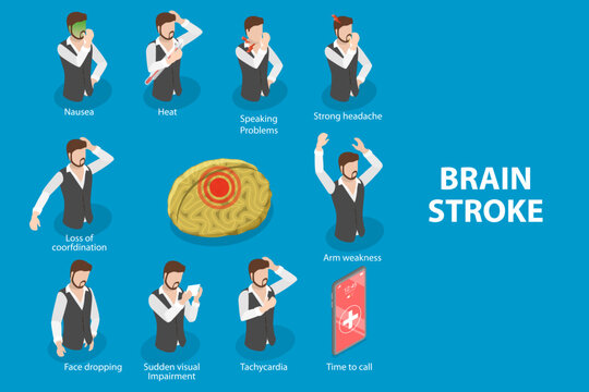 3D Isometric Flat Vector Illustration of Brain Stroke Symptoms, Medical Recognizing Diagram