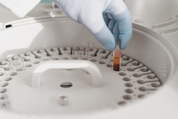 Close up of researcher hand in sterile glove putting test tube into laboratory centrifuge