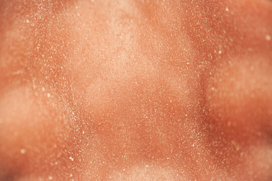 Close-Up View of Dewdrops on Peach Skin Texture in Natural Light