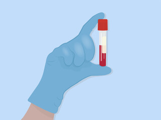 Vector illustration of a laboratory assistant, doctor's hand in gloves holding a test tube with blood, red liquid.