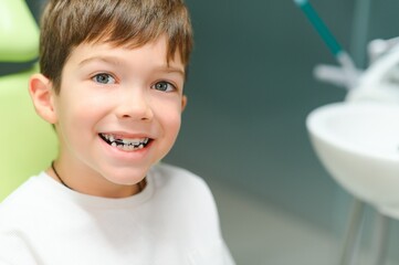 The boy inserts an orthodontic plate in his mouth
