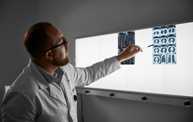 Side view of male doctor studying MRI results. Male specialist working in hospital, carrying out...