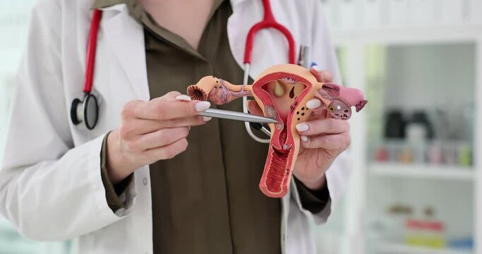 Doctor gynecologist demonstrates model of female reproductive system