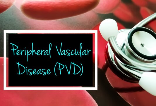 Peripheral vascular disease (PVD) medical term, PVD is a systemic disorder that involves the narrowing of peripheral blood vessels