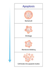 Apoptosis. Programmed cell death. Aging process in cells. Stages of apoptosis, normal cell, shrinkage, membrane blebbing, cell breaks into apoptotic bodies and phagocytosis. vector illustration.
