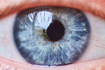 Blue and Gray Iris Macro with Eyelashes and Blood Vessels