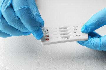 Doctor dropping buffer solution onto disposable multi-infection express test cassette at white...
