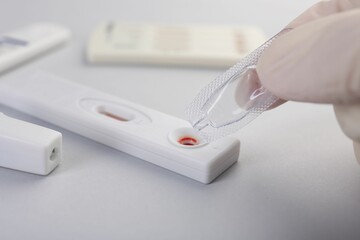 Doctor dropping buffer solution onto disposable express test cassette on light background, closeup