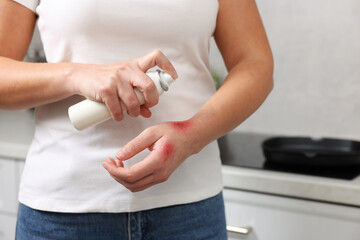 Woman applying panthenol onto burns on her hand in kitchen, closeup. Space for text