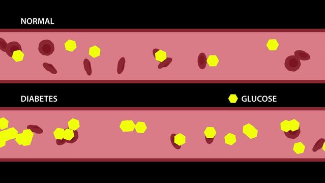 Compare Normal and Diabetes. Animation of Glucose