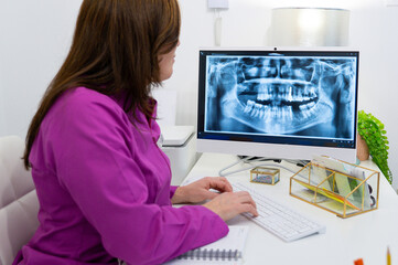 Fototapeta na wymiar Female dentist in her office looking at an x-ray on her computer