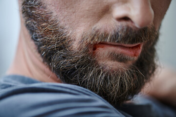cropped view of anxious man biting his lips till blood during depressive episode, mental health