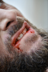 cropped view of anxious man biting his lips till blood during depressive episode, mental health