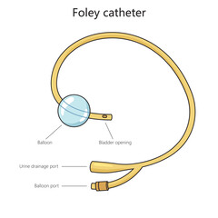Urinary foley catheter structure diagram hand drawn schematic vector illustration. Medical science educational illustration