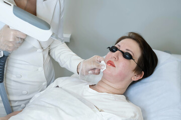 Advanced laser works on lip tattoo, image of modern correction. Emphasizes the evolution of cosmetic procedures.