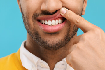 Fototapeta premium Man showing his healthy teeth and gums on light blue background, closeup