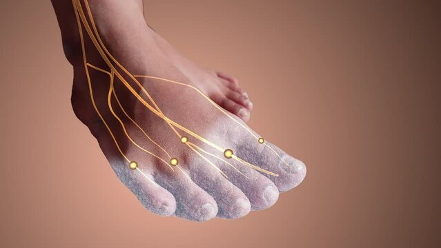 Tingling nerve injury in foot