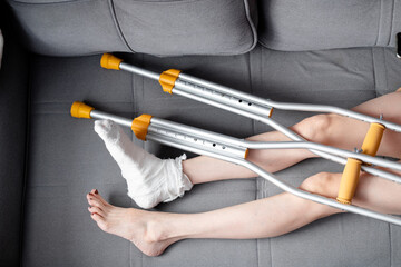 Woman with beautiful, long legs and a cast on her right leg with crutches lies on the sofa, top view