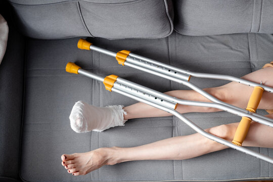 Woman with beautiful, long legs and a cast on her right leg with crutches lies on the sofa, top view