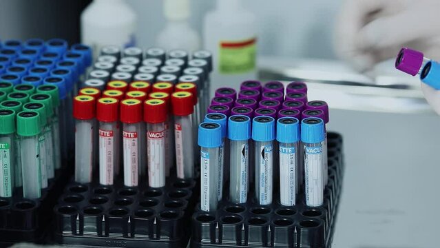  coagulation sodium citrate, Hand takes several test vacuum tubes with different color caps