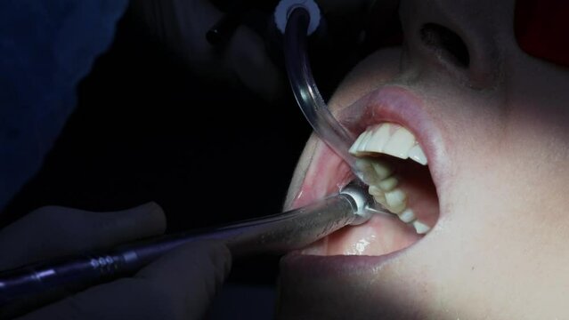 Dentist bores tooth of patient near saliva sucker in mouth