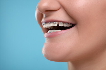 Happy woman with dental braces on light blue background, closeup. Space for text