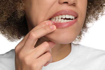 Woman showing her clean teeth on white background, closeup
