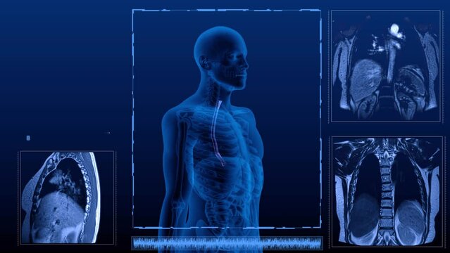 Magnetic resonance tomography  scan in different projections of the human digestive system. Anatomically accurate 3d render animation of the esophagus