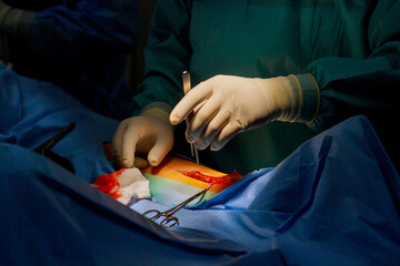 During surgery, doctors stitch up leg that has been injured