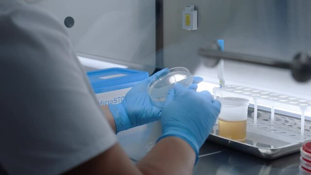 Female scientist works with urine test, spreads sample on petri dish for biochemical analysis in modern clinic laboratory. Medical worker does biotechnology or pharmaceutical research in advanced lab.