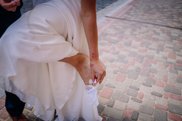 Fototapeta na wymiar Valmiera, Latvia - July 7, 2023 - bride adjusts her shoe, revealing a skin condition on her ar